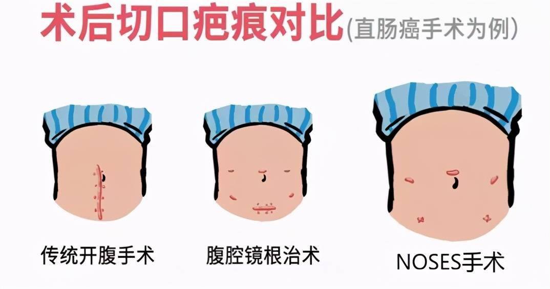 濮阳最新感染,濮阳最新感染，疫情下的城市挑战与应对策略